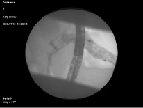 missing image file