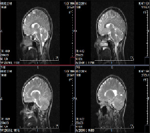 missing image file