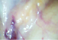 hol1.tiff