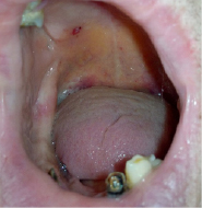 gula2.tif