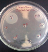 bio11.tif